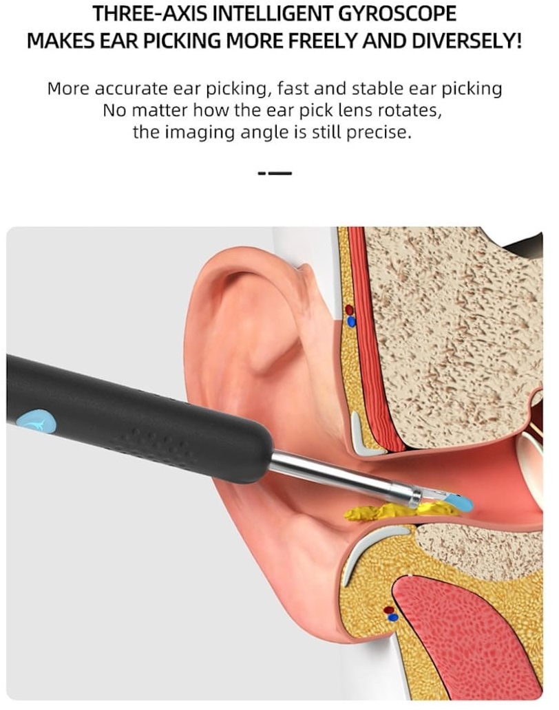 odstranjivač ušnog voska s kamerom za čišćenje ušiju
