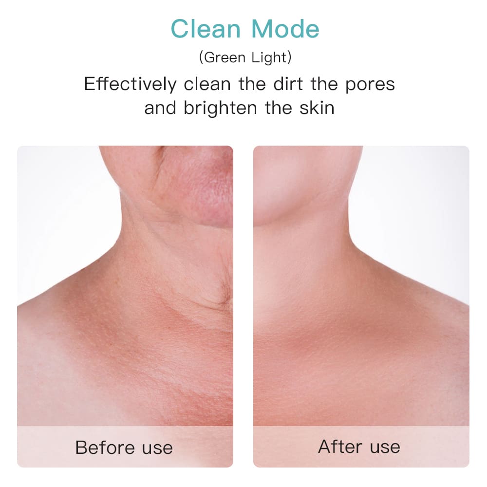 Učinkovit čistač pora na licu ili vratu prije poslije